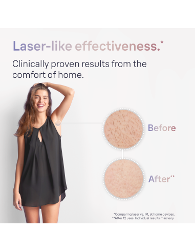 PL7147 Skin i·expert Pro7 IPL Fotoepiliatorius