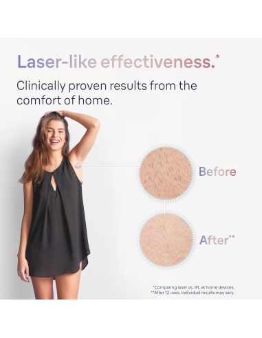 PL7147 Skin i·expert Pro7 IPL Fotoepiliatorius