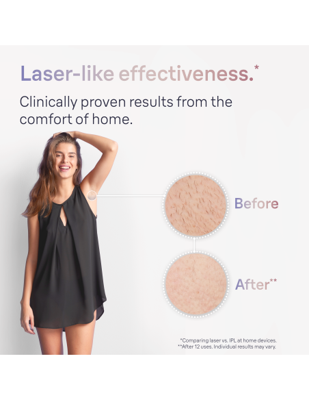 PL7147 Skin i·expert Pro7 IPL Fotoepiliatorius