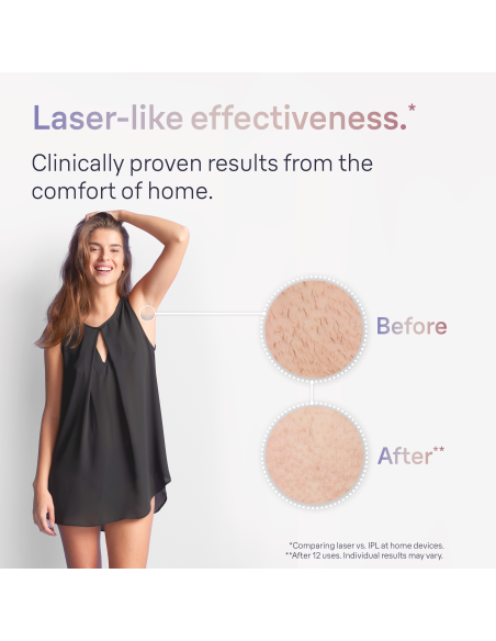 PL7147 Skin i·expert Pro7 IPL Fotoepiliatorius