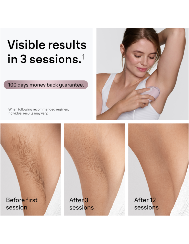 PL1100 Silk-expert IPL mini Fotoepilaator