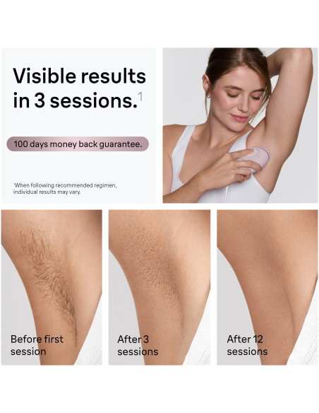 PL1100 Silk-expert IPL mini Fotoepilaator