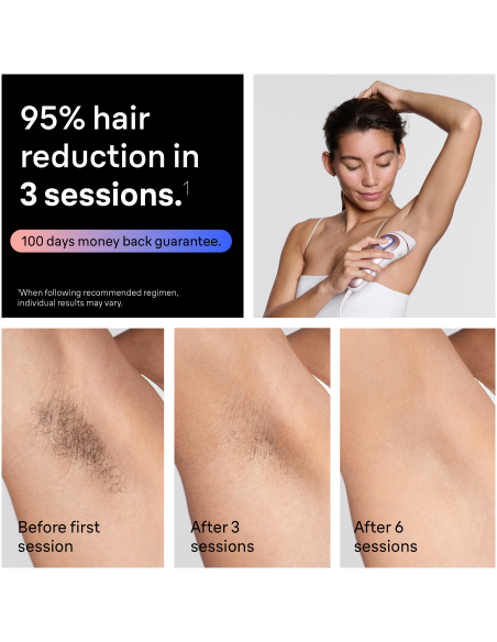 PL7321 Skin i·expert Pro7 IPL Fotoepilaator