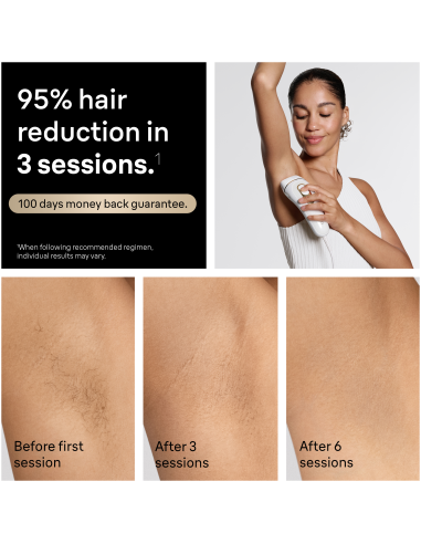 PL5351 Silk-expert Pro 5 IPL Fotoepilaator