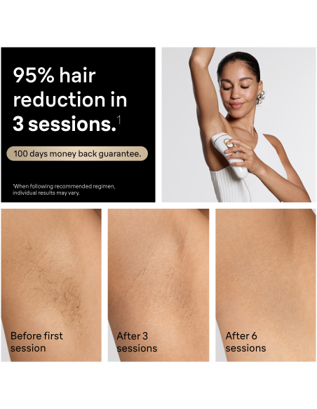 PL5351 Silk-expert Pro 5 IPL Fotoepilaator