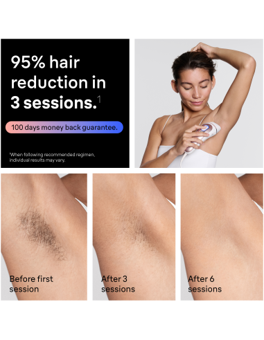 PL7431 Skin i·expert Pro7 IPL Fotoepilaator