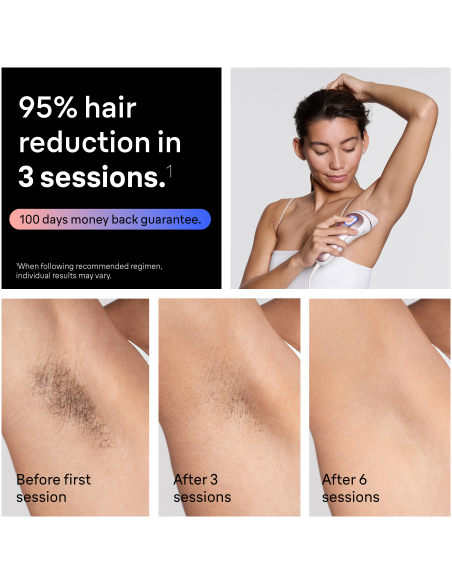 PL7431 Skin i·expert Pro7 IPL Fotoepilaator