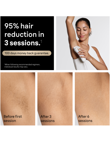 PL5221 Silk-expert Pro 5 IPL Fotoepilators
