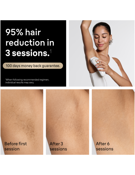 PL5351 Silk-expert Pro 5 IPL Fotoepilators